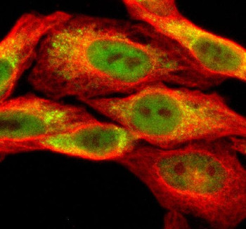 Anti-SESN3 / Sestrin 3