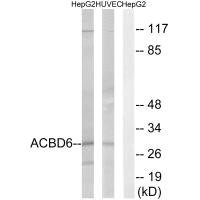 Anti-ACBD6