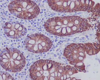Anti-KRT20 / Cytokeratin 20 / CK20, clone CDI-11
