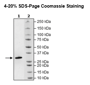 Histone H1, Full Length, His-tag Recombinant