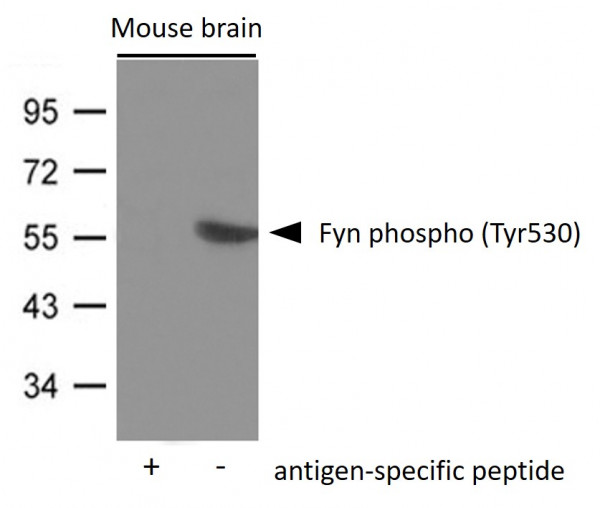 Anti-phospho-Fyn (Tyr530)