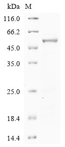 Phenylalanine-4-hydroxylase (PAH), human, recombinant
