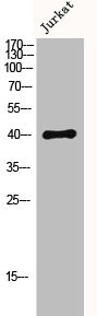 Anti-DUSP1/DUSP4