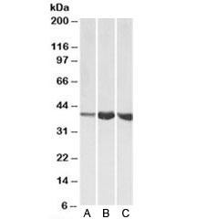 Anti-Aldolase A