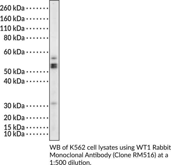 Anti-WT1 Rabbit Monoclonal (Clone RM516)