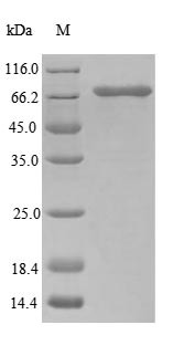Ubiquitin-associated domain-containing protein 1 (UBAC1) (Active), human, recombinant