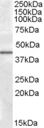 Anti-CAMK1D, C-terminal