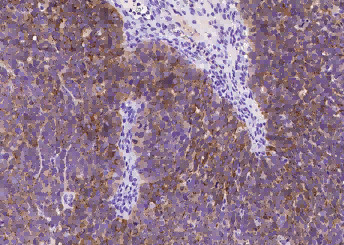 Anti-Mesothelin/MSLN Monoclonal Antibody