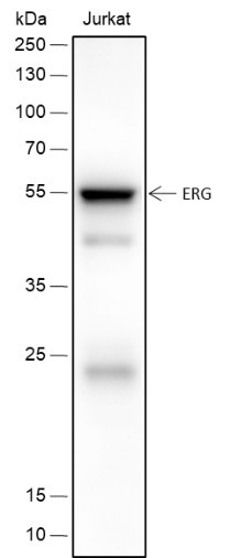 Anti-Recombinant ERG, clone A423