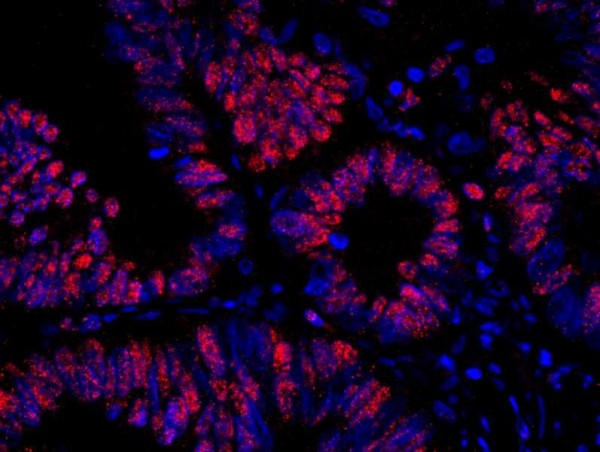 Anti-RanBP3 (IHC)