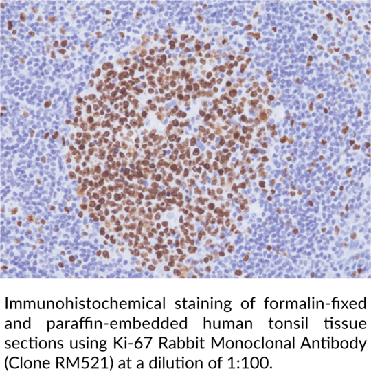 Anti-Ki-67 Rabbit (Clone RM521)