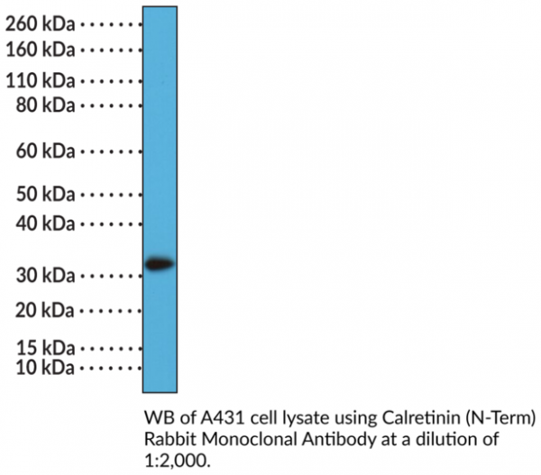 Anti-Calretinin (N-Term) Rabbit Monoclonal Antibody (Clone RM324)