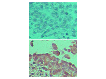 Anti-Lysyl Oxidase