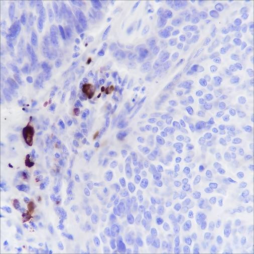 Anti-Recombinant IGJ, clone A268