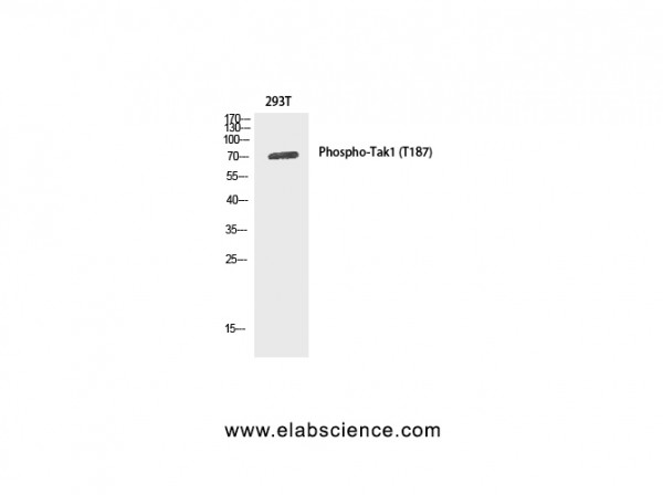 Anti-Phospho-Tak1 (Thr187)