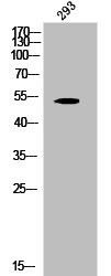 Anti-Phospho-KRT8 (S432)