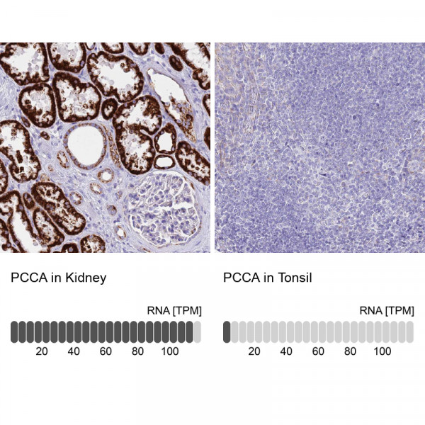 Anti-PCCA