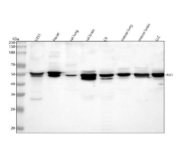Anti-IRX1 / Iroquois-class homeodomain protein