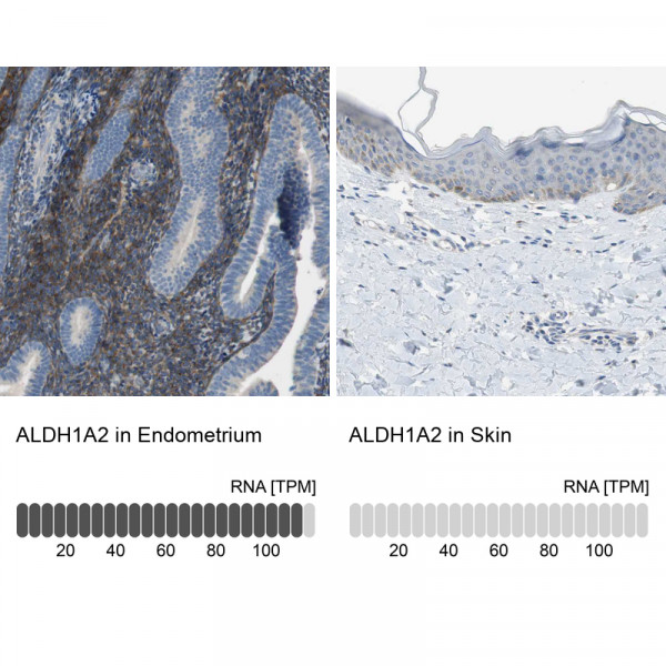Anti-ALDH1A2