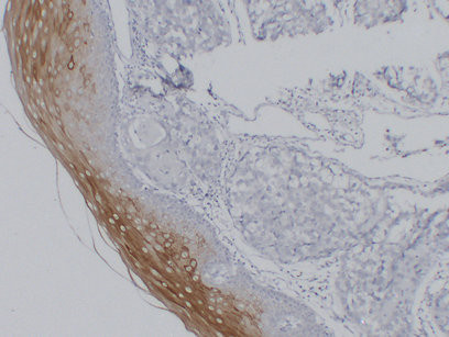 Anti-Cytokeratin 4