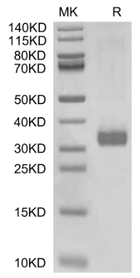 MBL2/Mannan Binding Lectin, His, Human