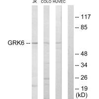 Anti-GRK6