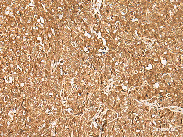 Anti-GMEB2