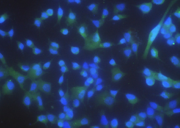 Anti-PPM1A/PP2CA/PP2C-alpha Monoclonal Antibody