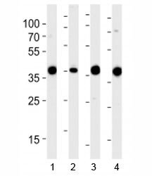 Anti-Aldolase