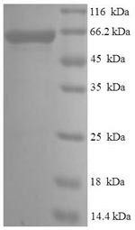 Serine/threonine-protein kinase PAK 4 (PAK4), human, recombinant