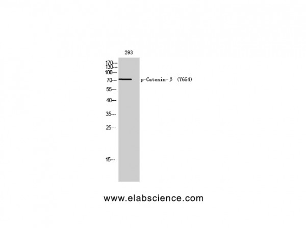 Anti-Phospho-Catenin-beta (Tyr654)