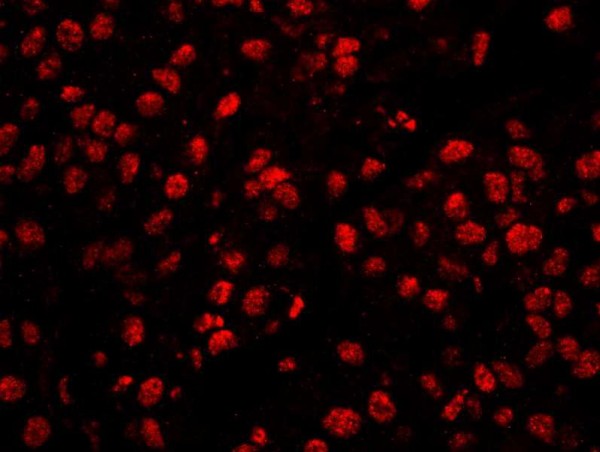 Anti-CPSF160 (IHC)