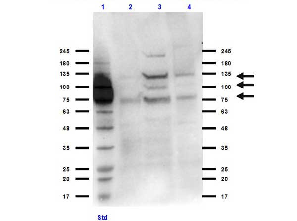 Anti-Integrin beta 3