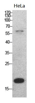 Anti-Pleiotrophin