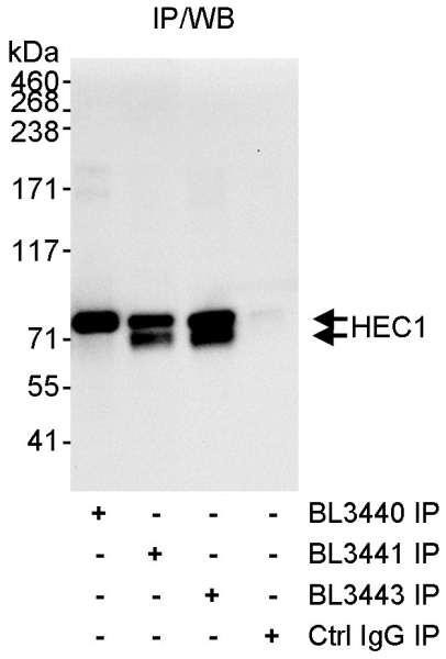 Anti-HEC1