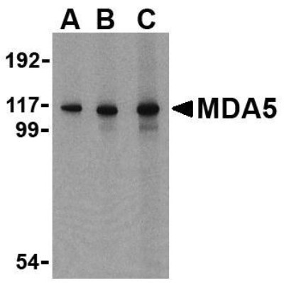 Anti-IFIH1 / MDA5