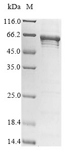 5-Aminolevulinate synthase, erythroid-specific, mitochondrial (Alas2), mouse, recombinant