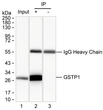 Anti-GSTP1