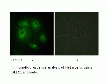 Anti-DLEC1