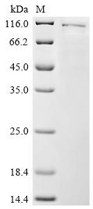 DNA topoisomerase 1 (TOP1), recombinant human