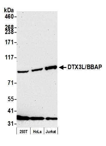Anti-DTX3L/BBAP