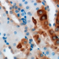 Anti-ERGIC2
