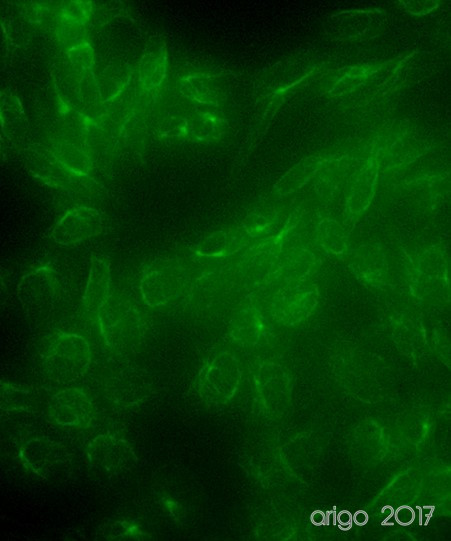 Anti-Vimentin, clone 4F8-A5-H5