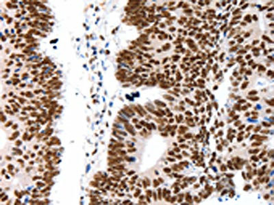 Anti-LIFR