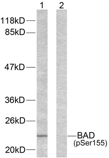 Anti-phospho-Bad (Ser155)