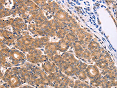 Anti-BTG3