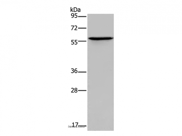 Anti-ADRA1B