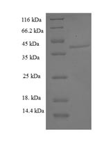 Aspartyl/asparaginyl beta-hydroxylase (ASPH), partial, human, recombinant
