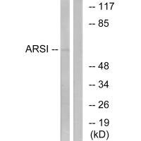 Anti-ARSI