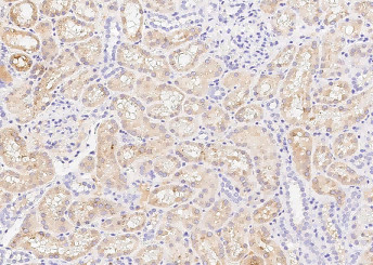 Anti-ENTPD5 Monoclonal Antibody